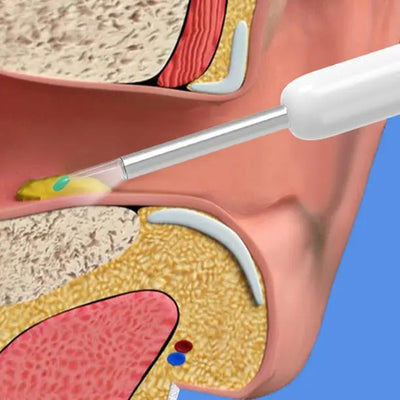 Cleanear - Nachhaltige & sichere Ohrenreinigung-0-Dalson-Dalson.ch