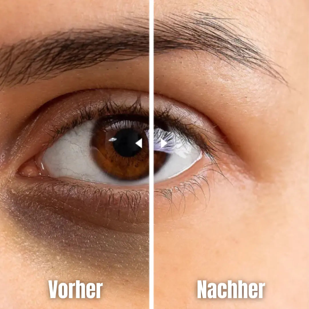 EyeCare - Das beliebteste Beautytool-Dalson-Dalson.ch