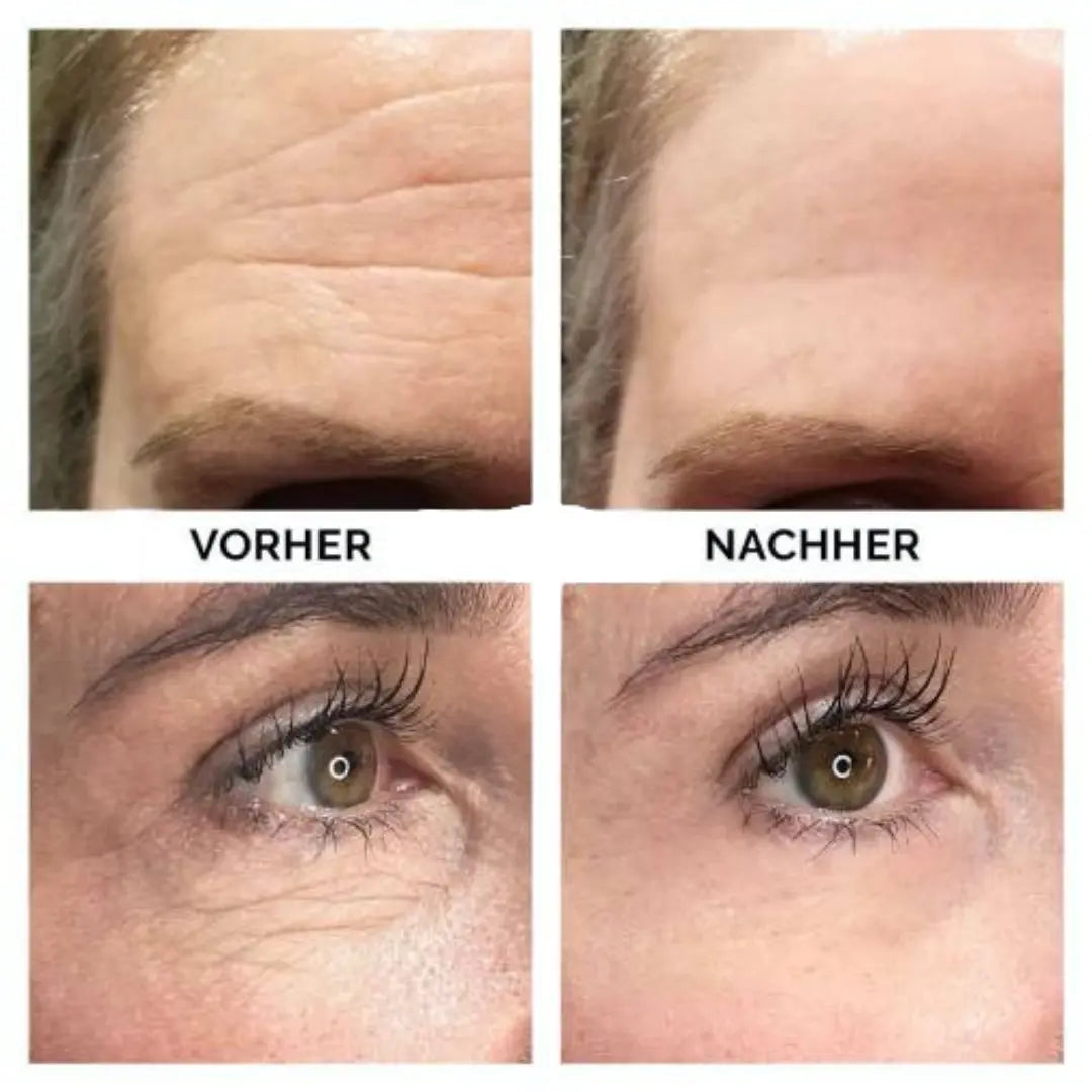 Skincare Stick™ - Ohne Falten in die Zukunft-0-Dalson-Dalson.ch
