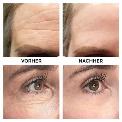 Skincare Stick™ - Ohne Falten in die Zukunft-0-Dalson-Dalson.ch