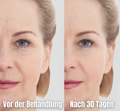 AgingVibe - In 30 Tagen zur makelloser Haut-Dalson-Dalson.ch