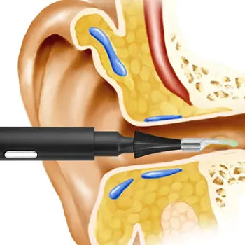 Cleanear - Nachhaltige & sichere Ohrenreinigung-0-Dalson-Dalson.ch
